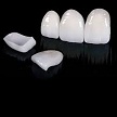 fixed removable hybrid prosthesis